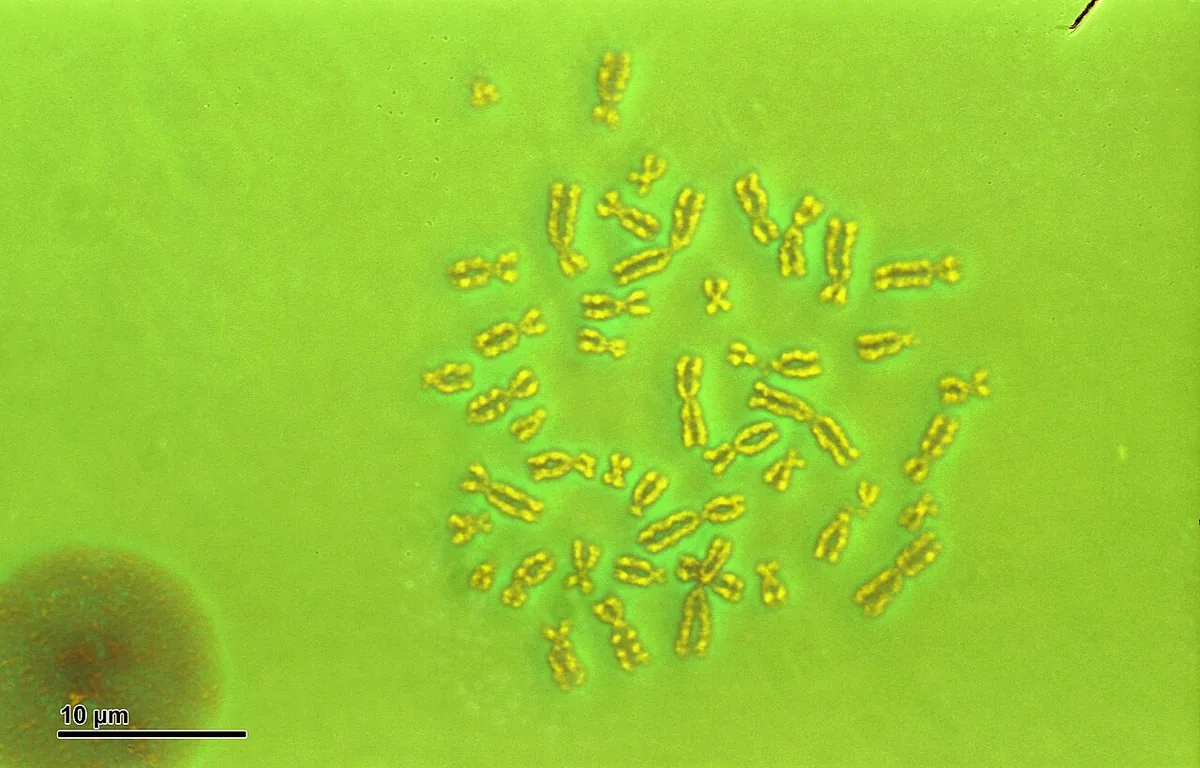 Caryotype humain masculin réel, 46,XY, chromosomes classés par taille en vue de microscope