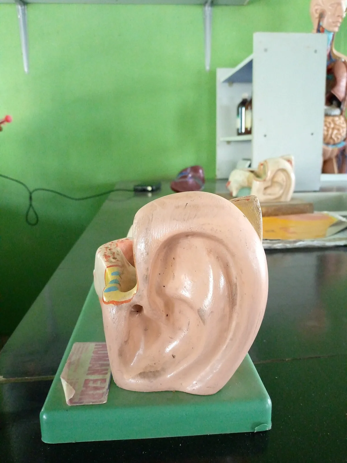Coupe anatomique de l'oreille humaine montrant le tympan et les osselets de l'oreille moyenne