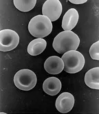 Micrographie de globules rouges humains en forme de disques biconcaves, colorés en rouge