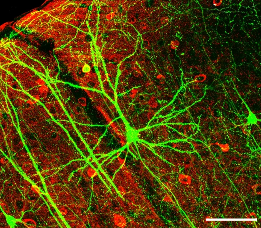 Le neurone