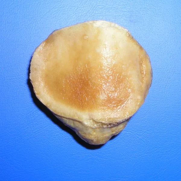 La patella